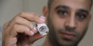 Tükürük Bezinden Taş Çıktı