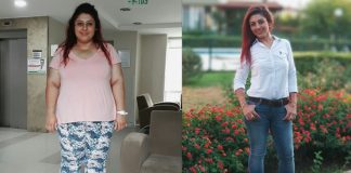 Tüp Mide Ameliyatıyla Diyabeti Son Buldu