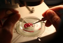 Akdeniz’de Yeni Denizel İstilacı…